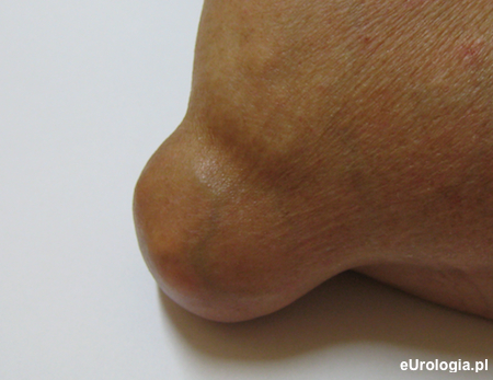 Dna - staw łokciowy