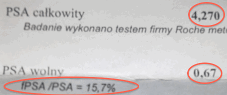 fPSA/tPSA - wskaźnik PSA wolny/ PSA całkowity