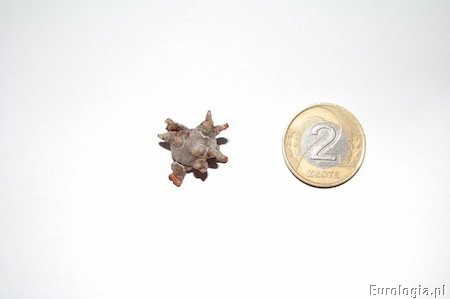 Kamica pęcherza moczowego