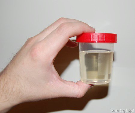 Badanie og&oacute;lne moczu - pr&oacute;bka