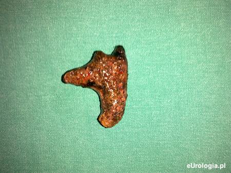 Kamica odlewowa - odlew układu zbiorczego nerki