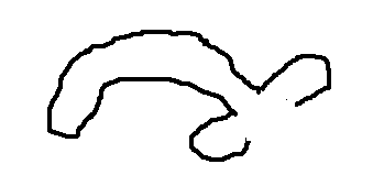 Skrzywienie penisa w czasie wzwodu