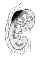 Uraz nerki I stopień