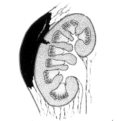 Uraz nerki II stopień