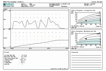 Uroflowmetria - wynik badania