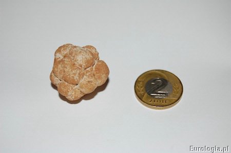 Zł&oacute;g z pęcherza moczowego